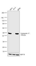Cytokeratin 17 Antibody