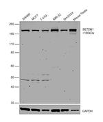 SETDB1 Antibody in Western Blot (WB)