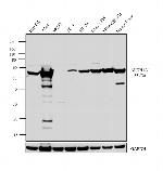 ALDH1A1 Antibody in Western Blot (WB)