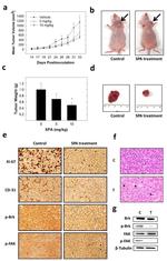 CD31 Antibody in Immunohistochemistry (IHC)