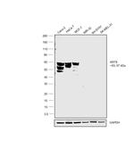 Cytokeratin 8 Antibody in Western Blot (WB)