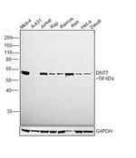 TdT Antibody