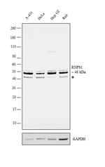 RNPS1 Antibody in Western Blot (WB)