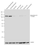 alpha Actinin 2/3 Antibody