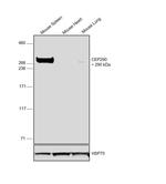 CEP290 Antibody in Western Blot (WB)