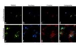 TREM2 Antibody in Immunocytochemistry (ICC/IF)