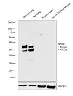 RAGE Antibody in Western Blot (WB)