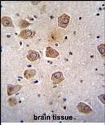 CLVS2 Antibody in Immunohistochemistry (Paraffin) (IHC (P))