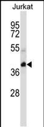 KCTD10 Antibody in Western Blot (WB)