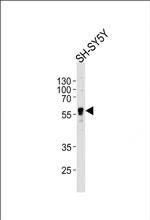 ABHD3 Antibody in Western Blot (WB)