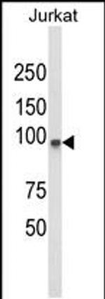 PLCL1 Antibody in Western Blot (WB)