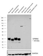 GPM6A Antibody in Western Blot (WB)