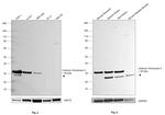 Carbonic Anhydrase II Antibody in Western Blot (WB)