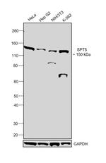 SPT5 Antibody in Western Blot (WB)