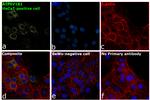 ATP6V1B1 Antibody in Immunocytochemistry (ICC/IF)