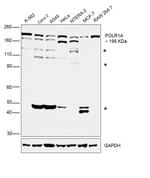 POLR1A Antibody in Western Blot (WB)