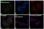 LAT Antibody