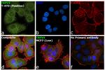 TRPV6 (extracellular) Antibody in Immunocytochemistry (ICC/IF)