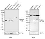 GABRA1 (extracellular) Antibody in Western Blot (WB)