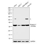 Annexin V Antibody in Western Blot (WB)