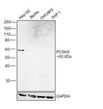 PCSK9 Antibody in Western Blot (WB)