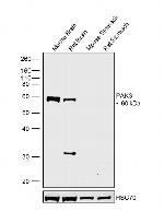 PAK3 Antibody in Western Blot (WB)