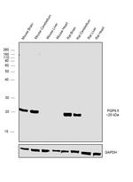 PGP9.5 Antibody in Western Blot (WB)