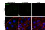 SGLT1 Antibody