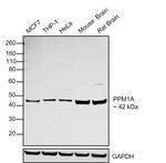 PPM1A Antibody in Western Blot (WB)