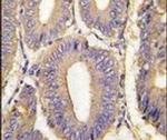 PAK1 Antibody in Immunohistochemistry (IHC)