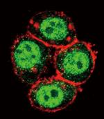 PAK1 Antibody in Immunocytochemistry (ICC/IF)