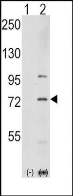 PAK1 Antibody in Western Blot (WB)