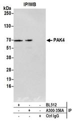 PAK4 Antibody in Western Blot (WB)