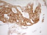 PAK4 Antibody in Immunohistochemistry (Paraffin) (IHC (P))