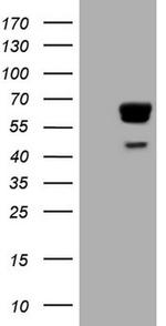 PAK4 Antibody in Western Blot (WB)