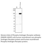 Phospho-Androgen Receptor (Ser568) Antibody in Western Blot (WB)