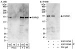 PARG1 Antibody in Western Blot (WB)