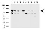 PARN Antibody in Western Blot (WB)