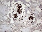 PARP1 Antibody in Immunohistochemistry (Paraffin) (IHC (P))