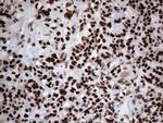 PARP1 Antibody in Immunohistochemistry (Paraffin) (IHC (P))