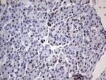 PARP1 Antibody in Immunohistochemistry (Paraffin) (IHC (P))