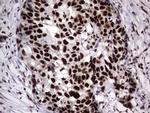 PARP1 Antibody in Immunohistochemistry (Paraffin) (IHC (P))