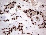 PARP1 Antibody in Immunohistochemistry (Paraffin) (IHC (P))