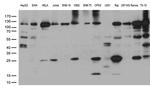 PARP1 Antibody in Western Blot (WB)