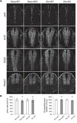 PAX3 Antibody in Immunohistochemistry (IHC)