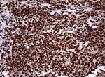 PAX5 Antibody in Immunohistochemistry (Paraffin) (IHC (P))