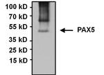 PAX5 Antibody in Immunoprecipitation (IP)