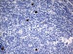 PBX1 Antibody in Immunohistochemistry (Paraffin) (IHC (P))