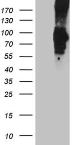 PCSK9 Antibody in Western Blot (WB)