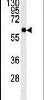 PCYOX1L Antibody in Western Blot (WB)